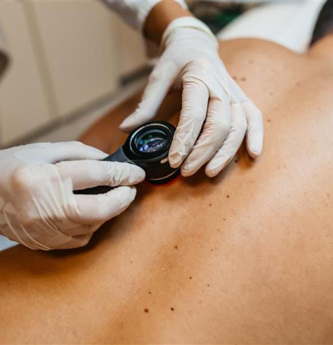 Skin Cancer Screenings